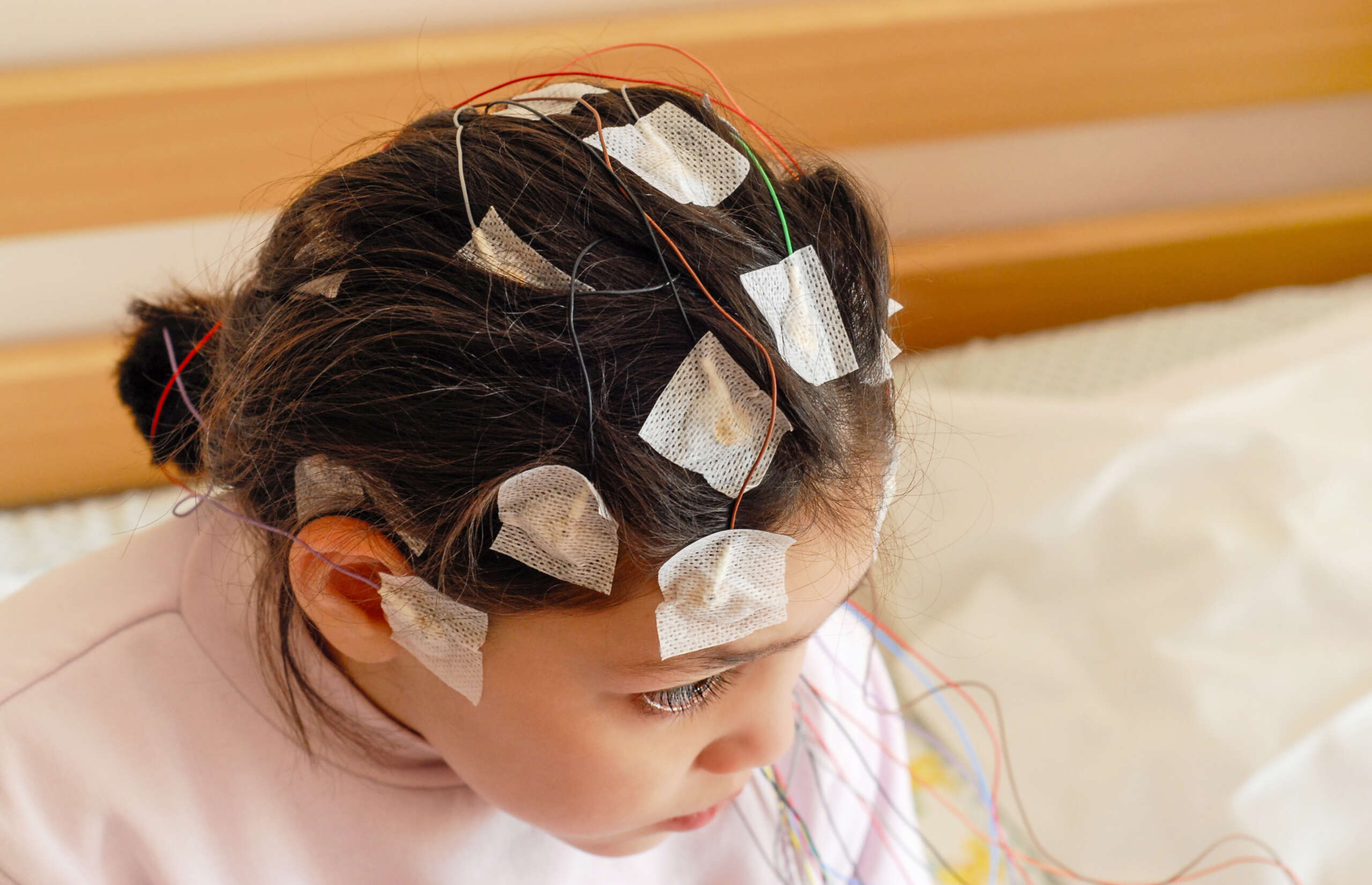 Girl,With,Eeg,Electrodes,Attached,To,Her,Head,For,Medical